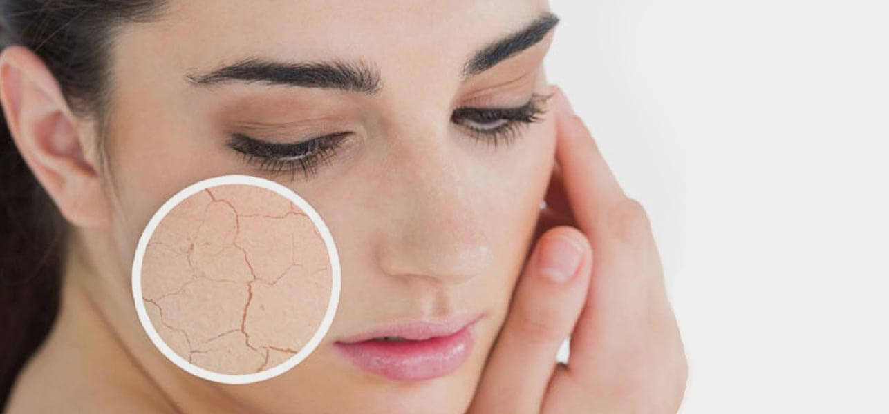 Kuru Ciltler İçin Maske Tarifleri ve Uygulama Şekilleri